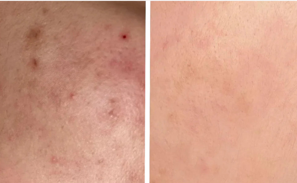 Poudre de figue de barbarie