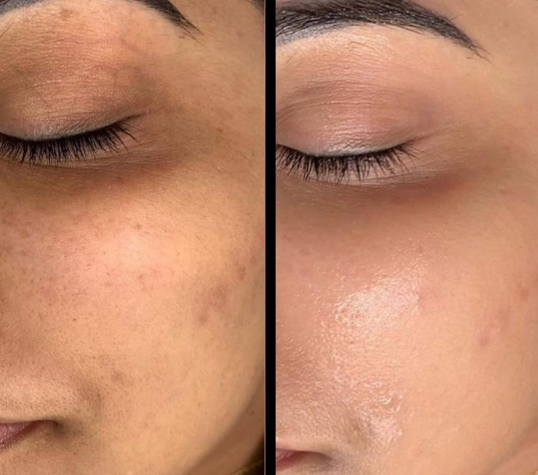 Huile de pépins de figue de barbarie bio  15 ml