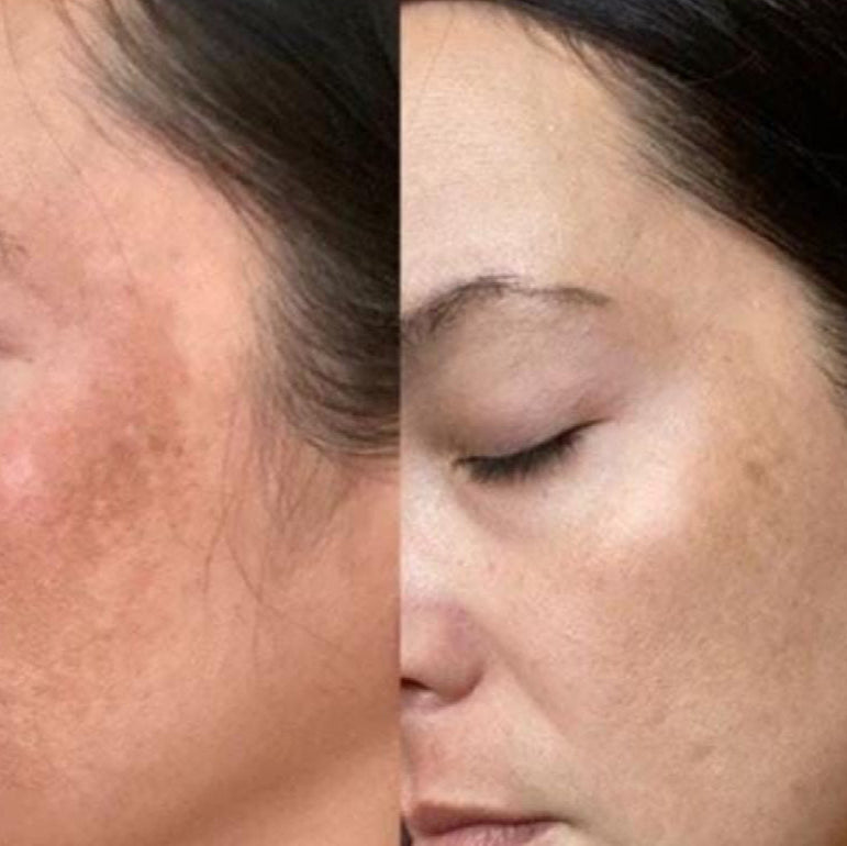 Poudre de figue de barbarie